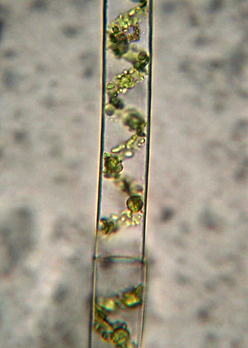 Azzardo: Spirogyra varians....?